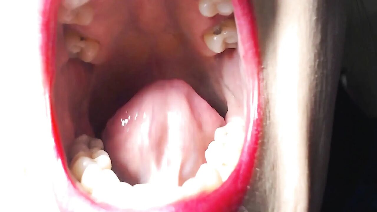 Big wide open mouth