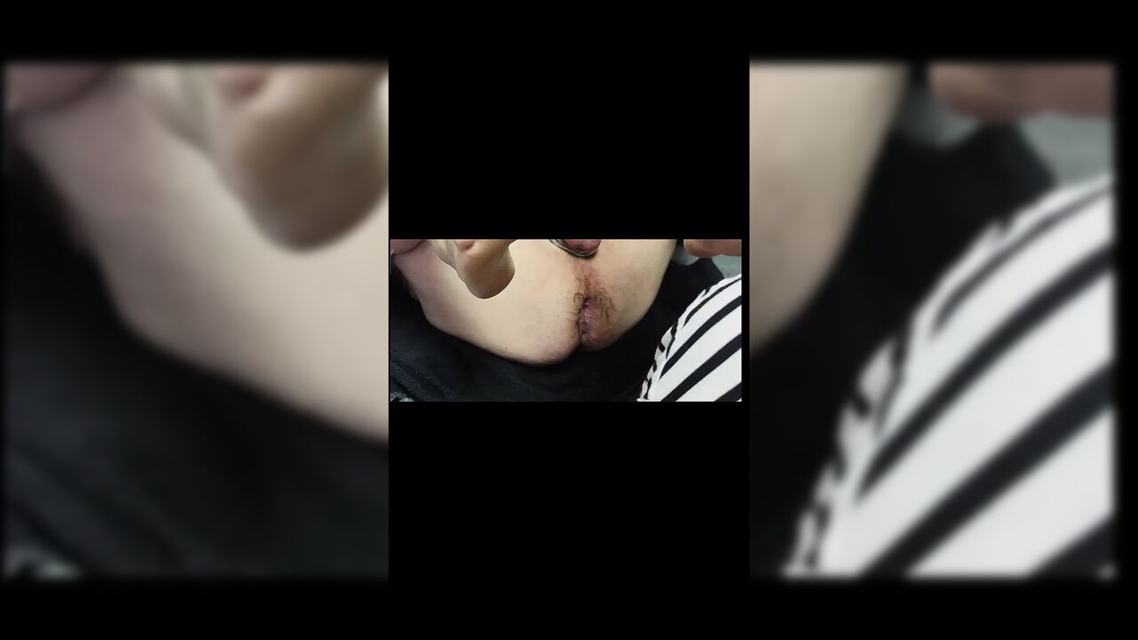 Anal fisting 3