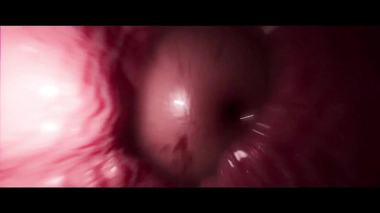 Standing Play (standart - X-ray)
