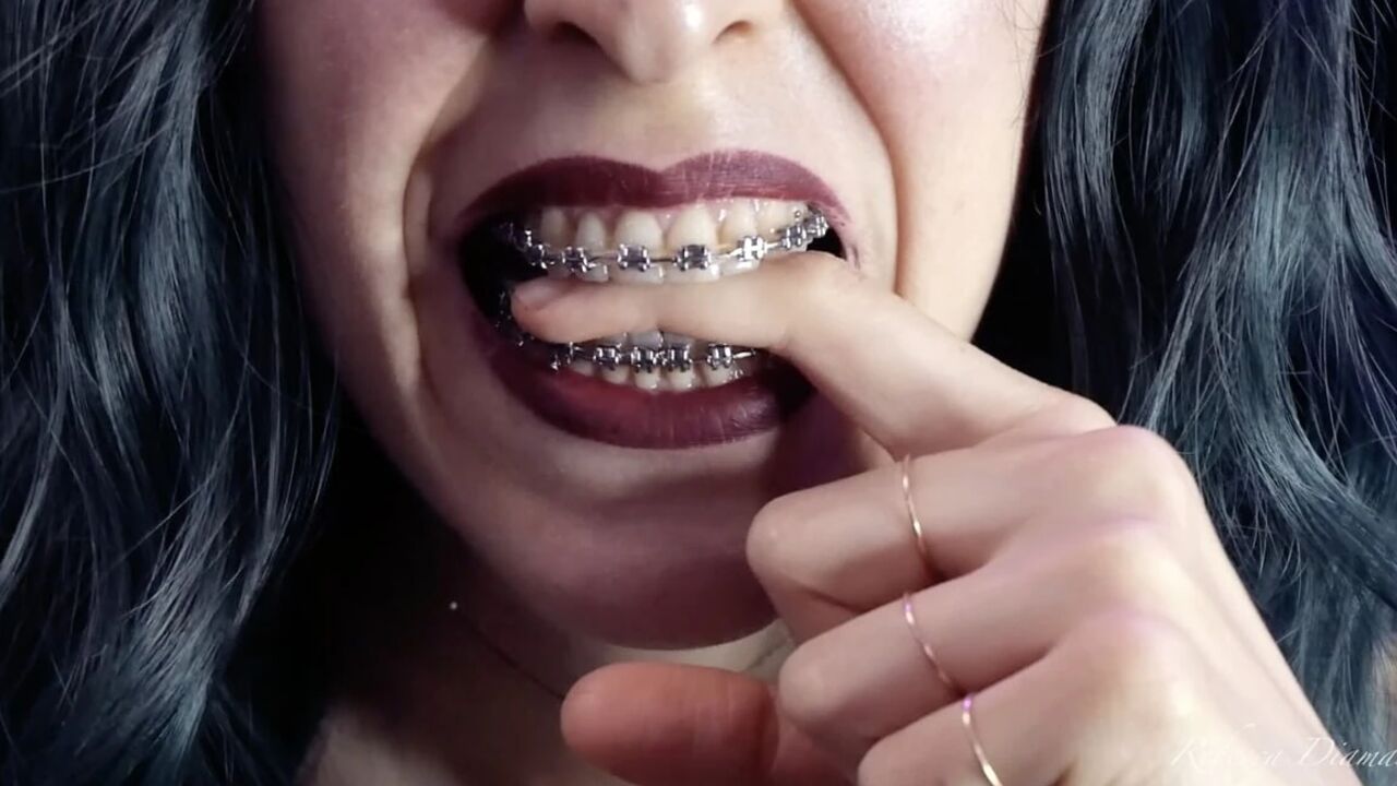 Biting My Fingers - Bite, Mouth, Teeth, Braces, Fetish Ita