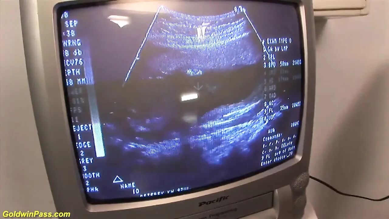 Redhead preggo fucked at the clinic