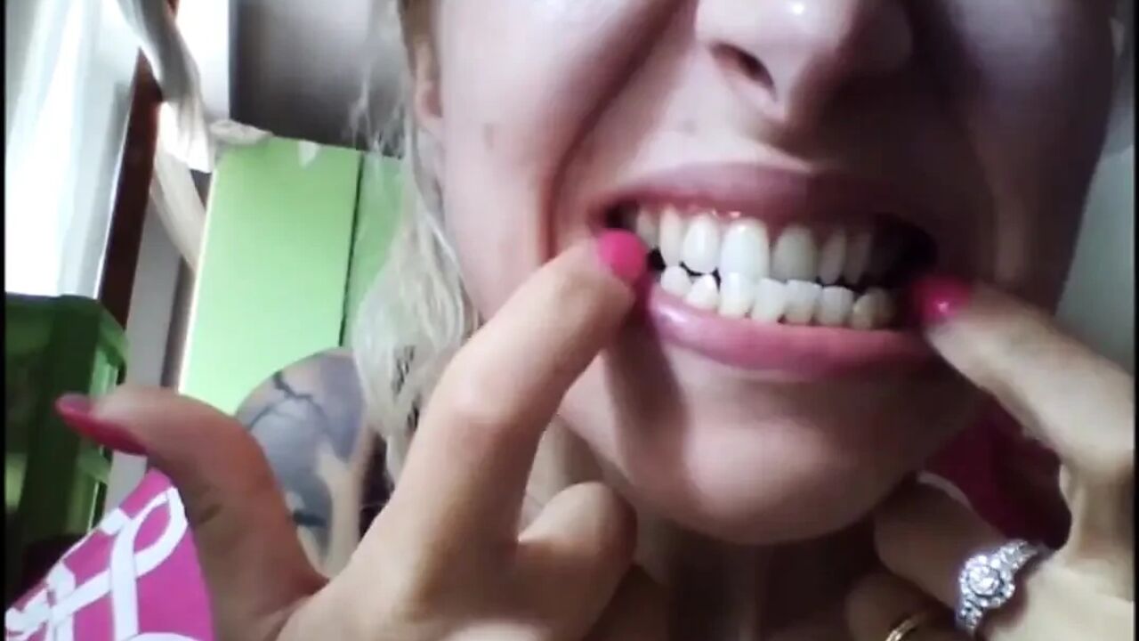 Beautiful Face, but Rotten Teeth!