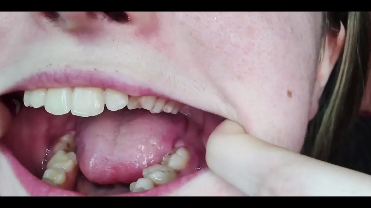 My Mouth, Teeth, Tongue and Throat up Close