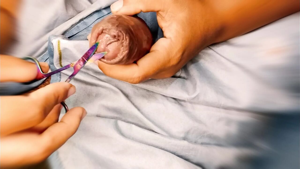 Foreskin Circumcision Roleplay Handjob