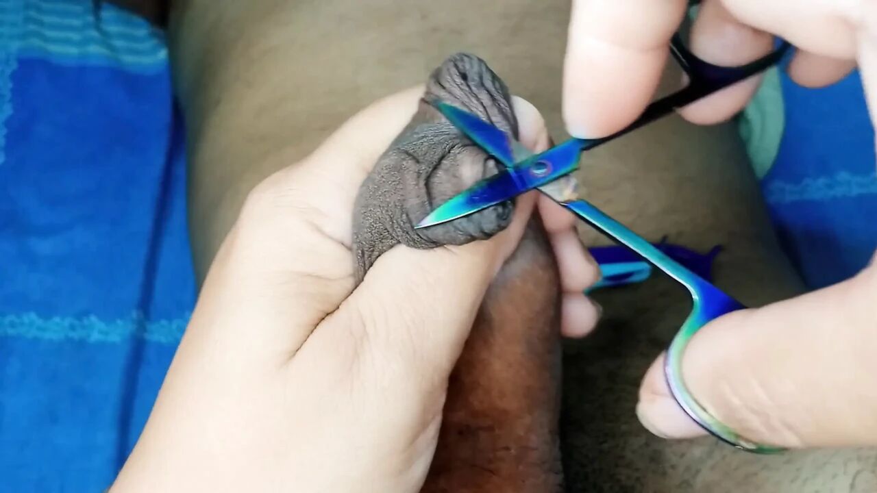 The Best Foreskin Circumcision Roleplay Handjob