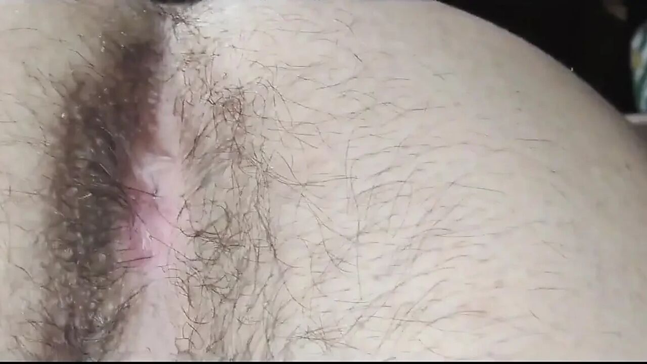 My Hairy Anus