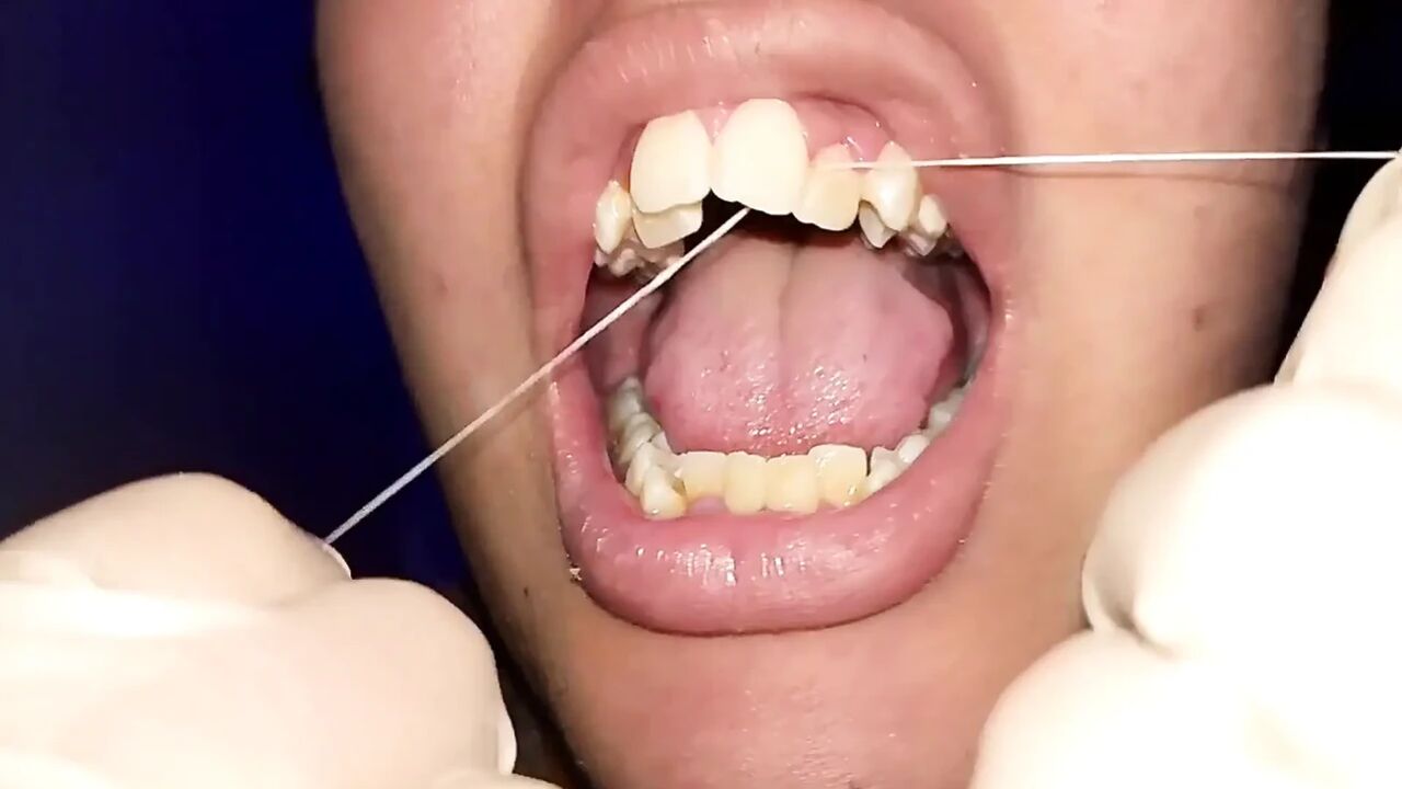 Trying to Use Dental Floss (close-up)
