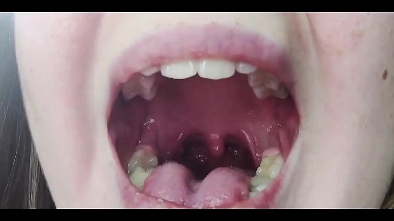 Throat Fetish