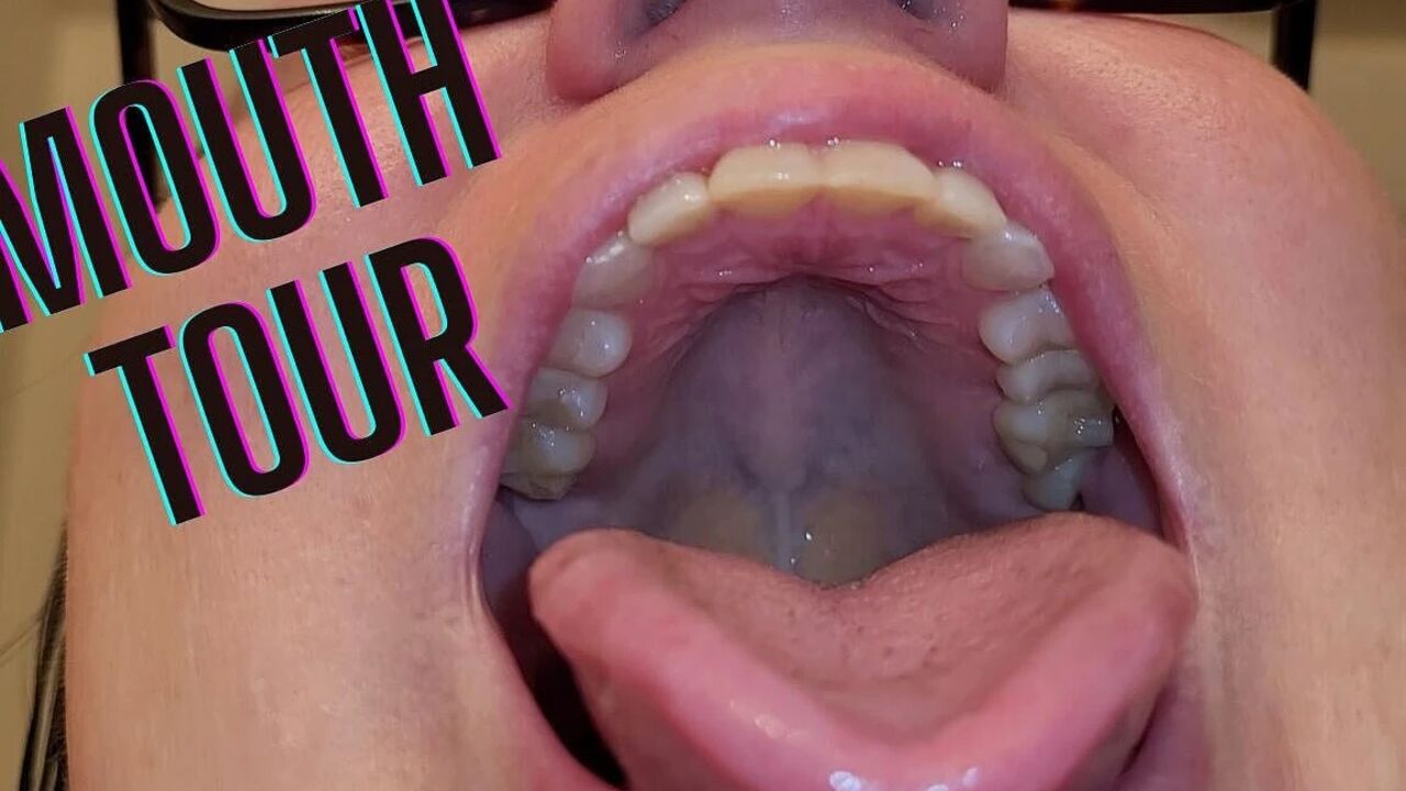 Mouth Tour with a Bottom Retainer