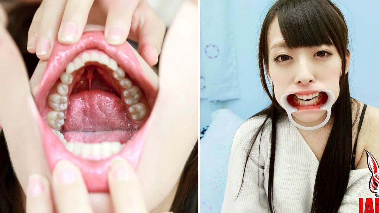 Ikumi Kuroki's Vulnerable Revelation: a Journey Into Dental Sensitivities and Unveiled Imperfections