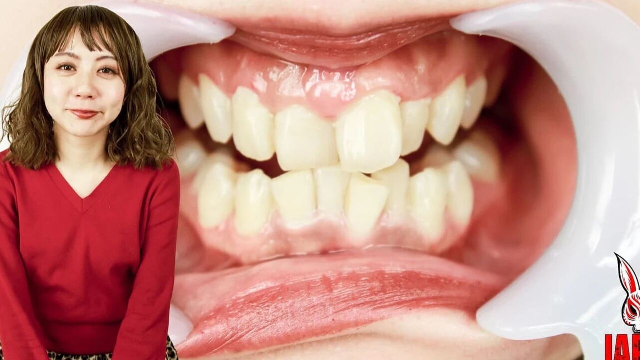 Inside Rumi's Mouth: Explore Her Dental Care Secrets!