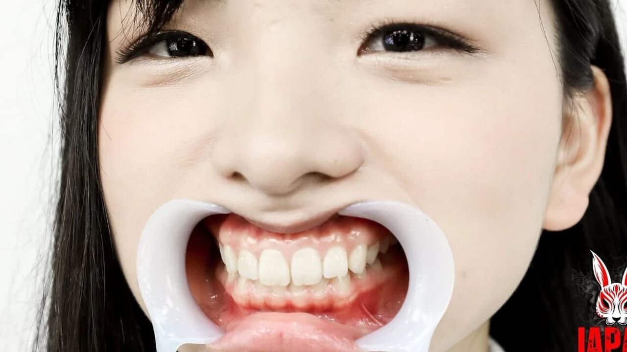 Teeth Observation Natural Teeth but Potential Cavities Found!! Beauty Winces When Her Teeth Are Tapped - Suzu Shiratori