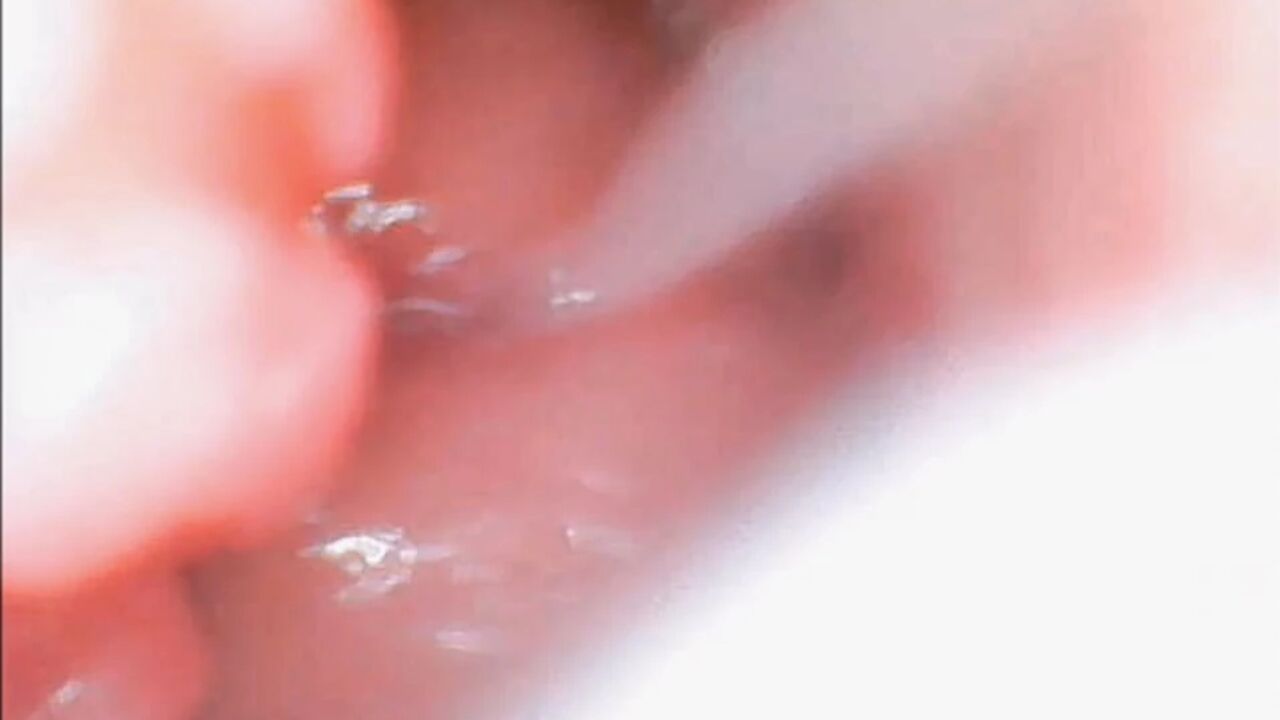 Endoscope Creampie. Cam Inside Pussy Shows Dick Cumming Inside Pussy