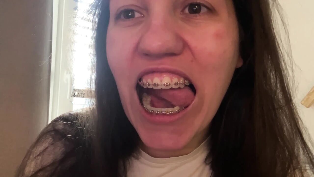 Licking Your Braces with Your Tongue