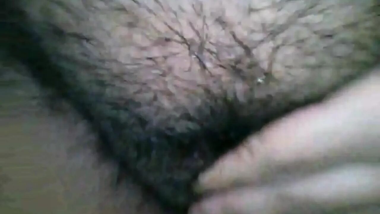 My hairy