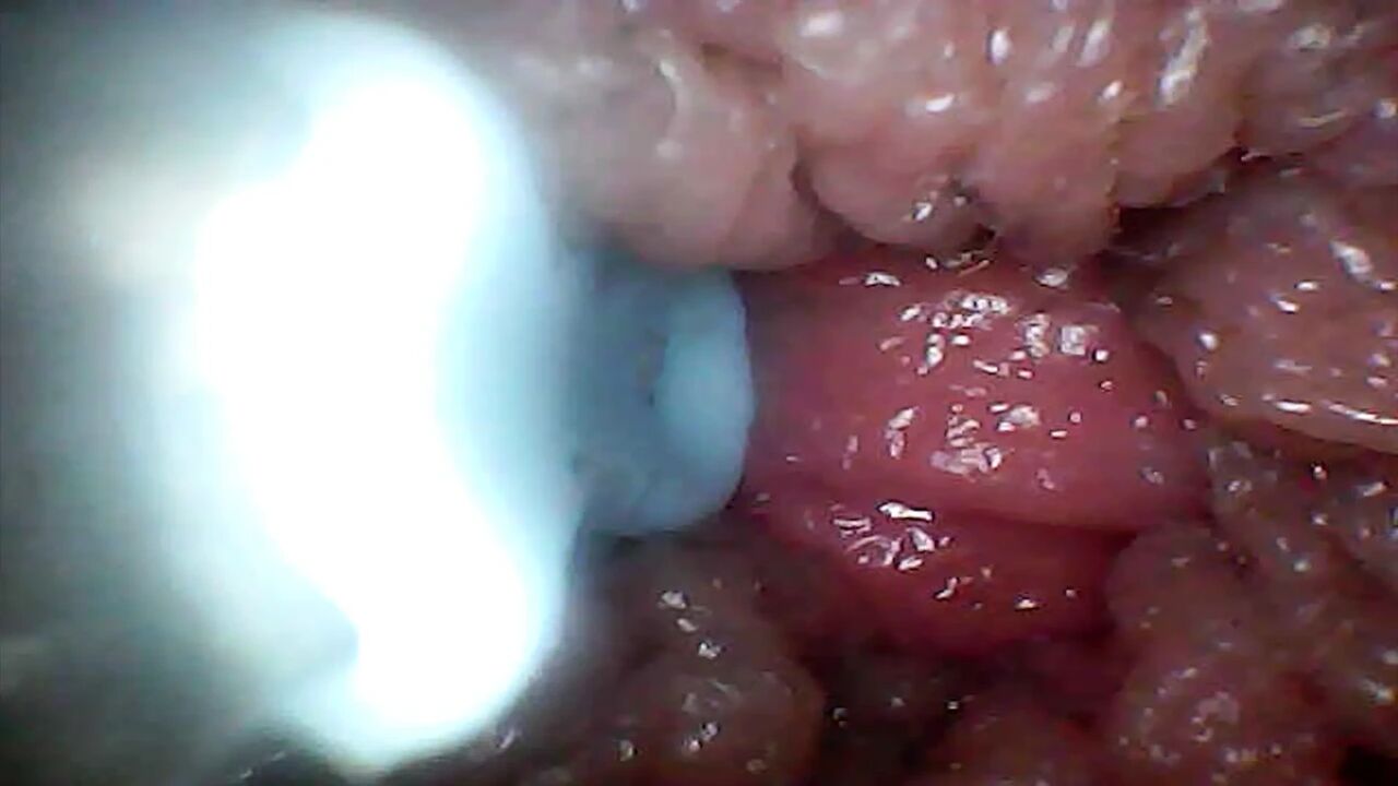 Extreme Proximity Turns Watcher Into Active, Hungry Participant