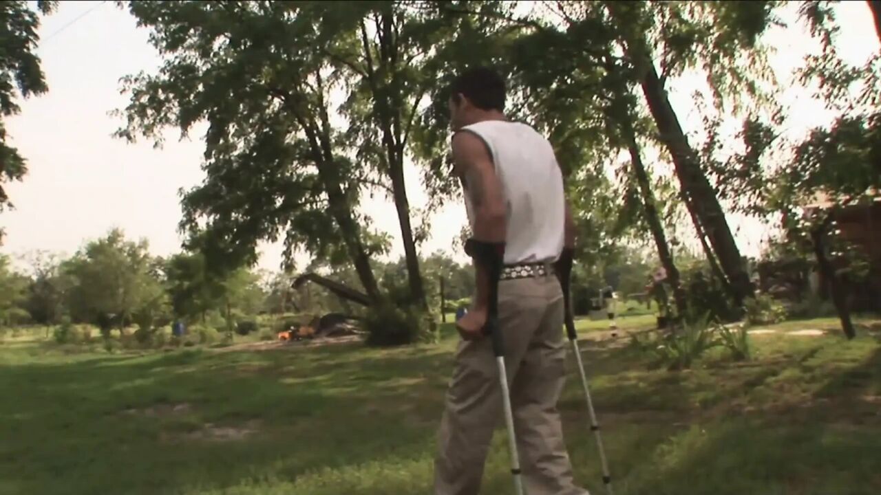 Amputee dude fucks her girlfriend outdoor