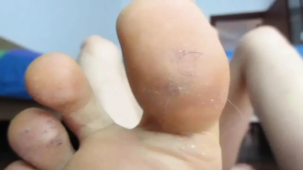 My Dirty Soles Feet, Right in Front of Your Face