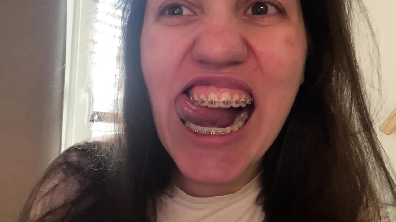 Licking Your Braces with Your Tongue