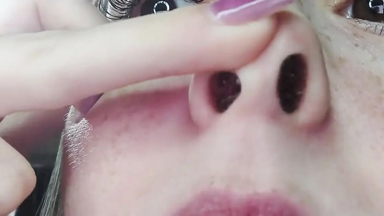 Runny Nose Close up